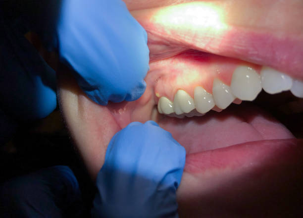 Best Cosmetic Emergency Dentistry in West Kennebunk, ME